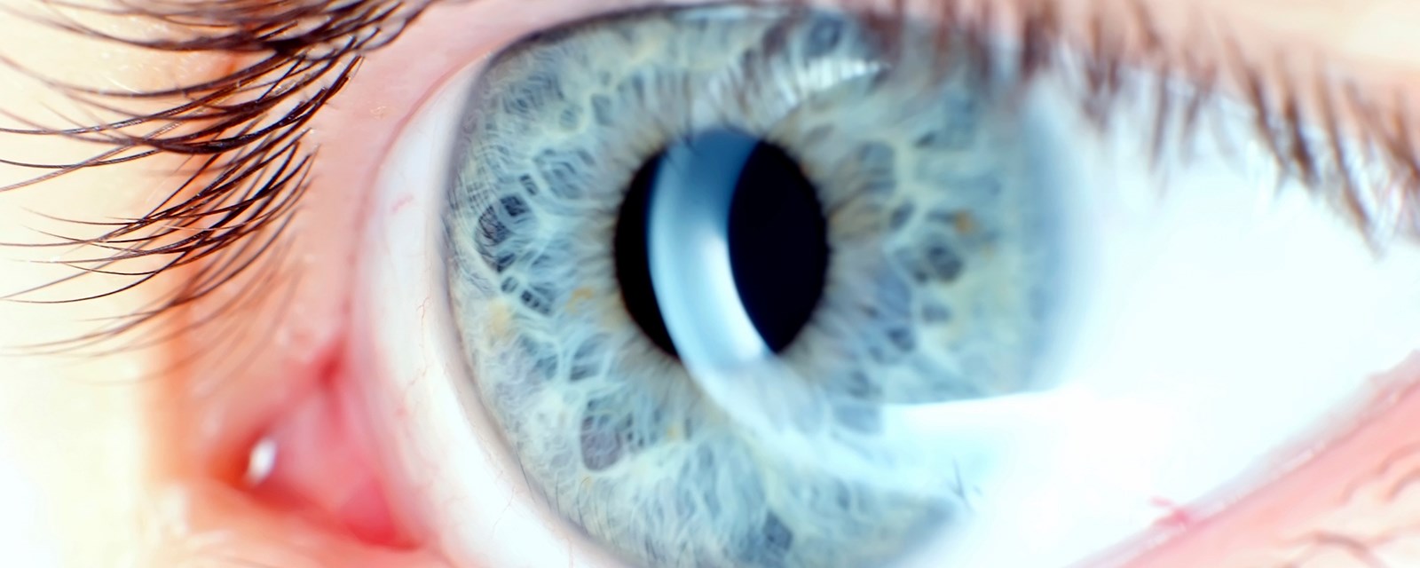 Пелена на глазах какие. Пелена в глазах расплывчатое зрение. Глаукома пелена перед глазами.